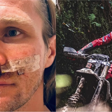 Tadeus Blazusiak sfregiato da un cavo d’acciaio: salvo per miracolo l’asso del motocross